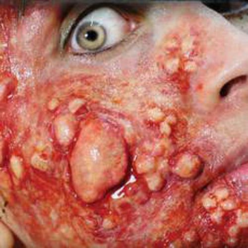 FX Transers / Outbreak