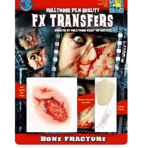 FX Transfers - Bone Fracture