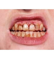 Tooth Enamel 12ml  Dancewear Australia