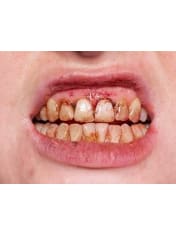 Tooth Enamel 12ml  Dancewear Australia
