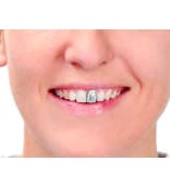Tooth Enamel 12ml  Dancewear Australia