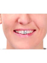 Tooth Enamel 12ml  Dancewear Australia